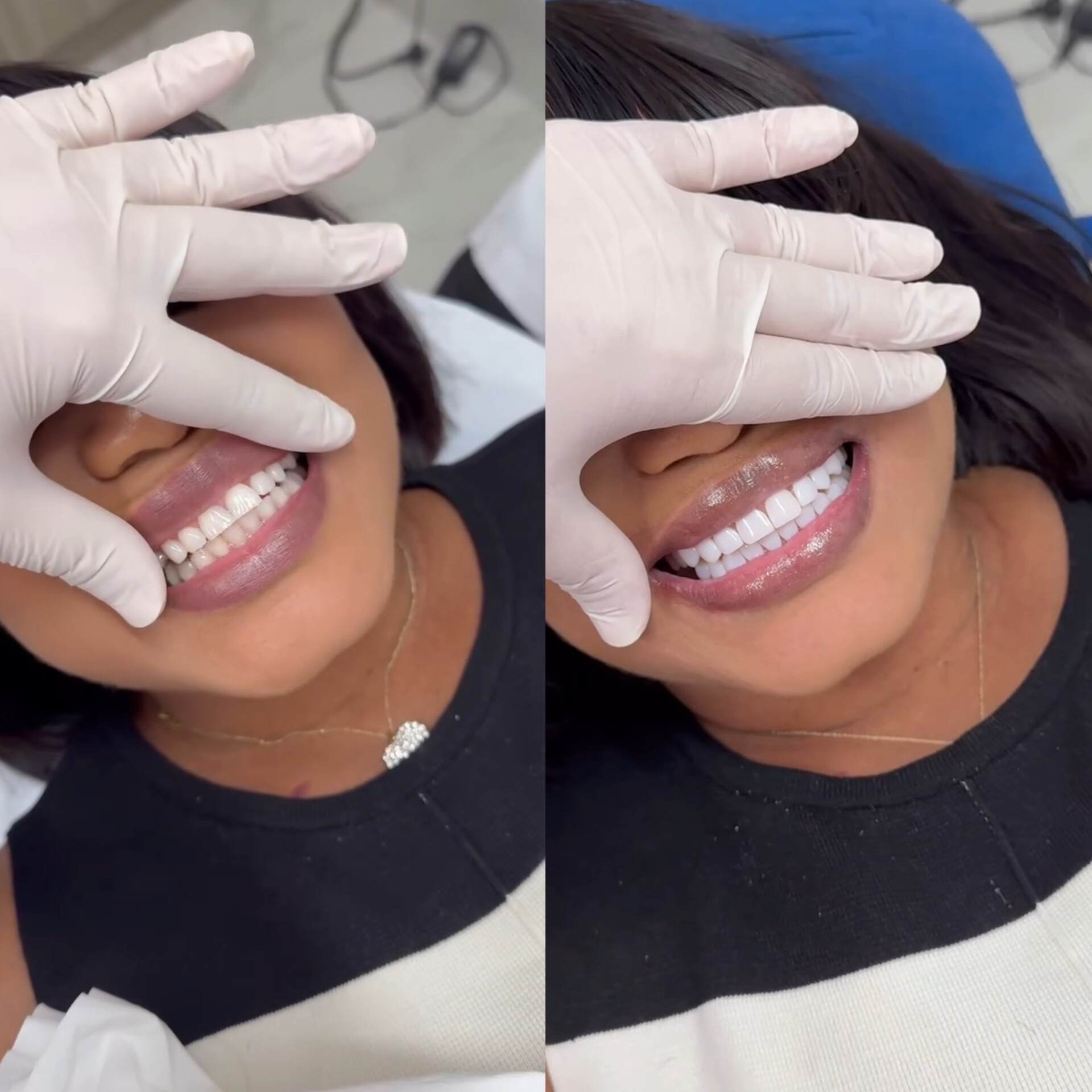 Transformation 1